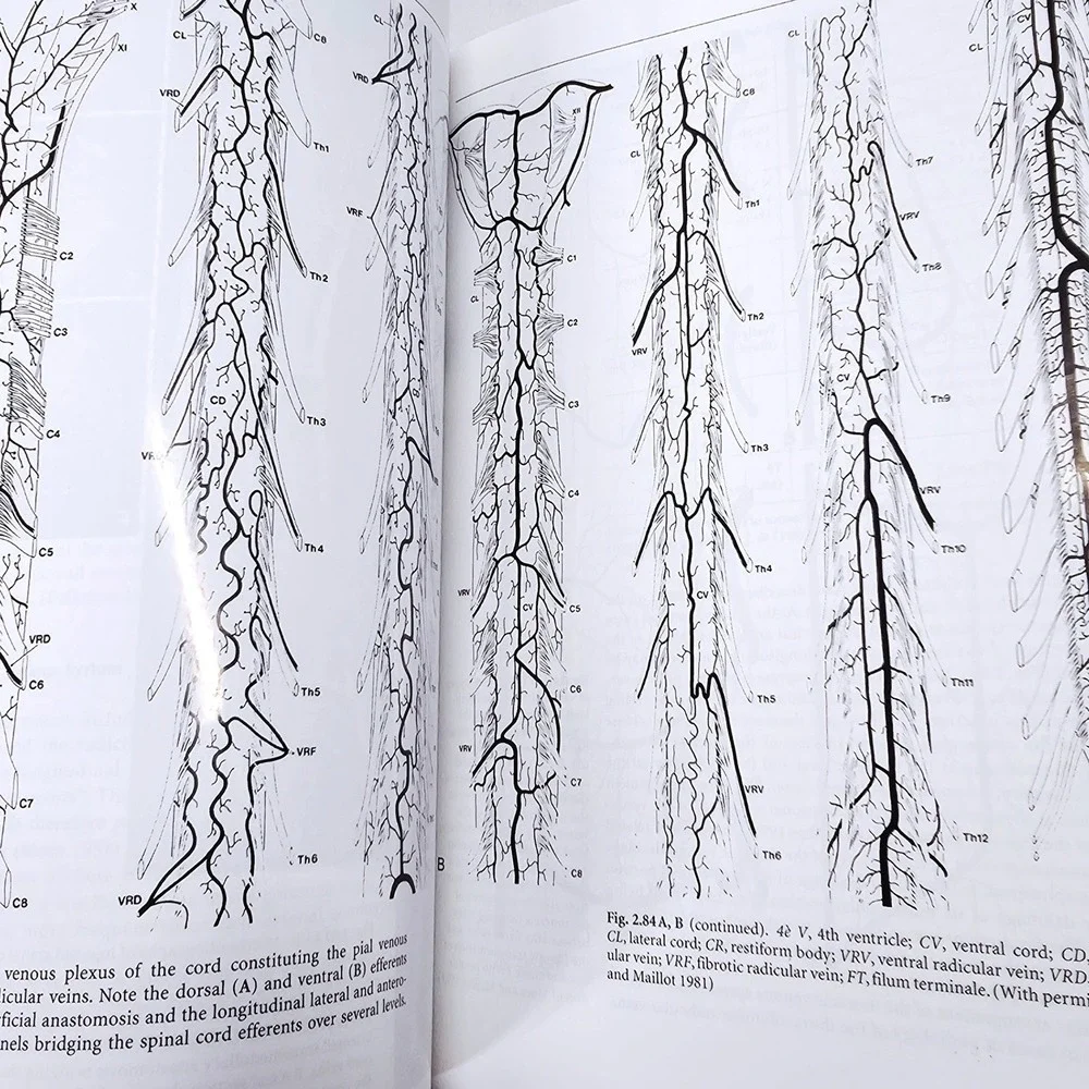 Springer Surgical Neuro-angiography 1 Clinical Vascular Anatomy‎ 2nd Ed GD